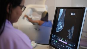 Nuevo mamógrafo de la CSS