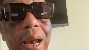 Japanese recauda 7 mil dólares y le dice a los fans: Esa plata no es para comer