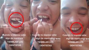 Manicurista pone acrílico en diente dañado de su esposo y se hace viral