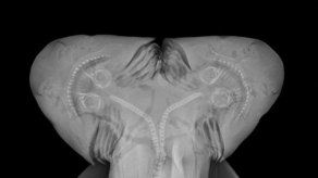 Confirman hallazgo de un feto vivo de tiburón con dos cabezas en Florida