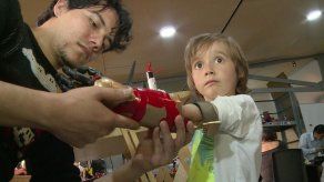 Niños superhéroes en Colombia gracias a prótesis de impresión 3D