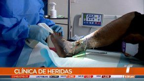 Afecciones como el pie diabético van en aumento en Panamá