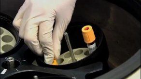 Estudio demuestra que el cobre acelera el desarrollo de células cancerígenas