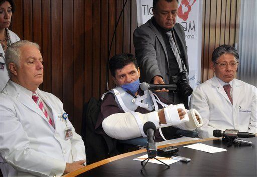 México anuncia primer trasplante de brazos en Latinoamérica