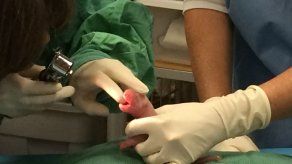 Alimentan con sonda a uno de los bebés panda del zoo de Washington