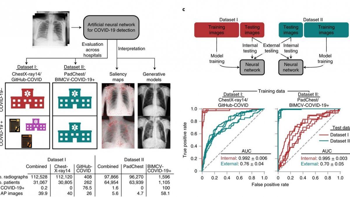Algunos modelos de inteligencia artificial usan radiografías pectorales para detectar covid.
