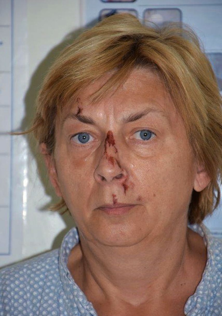 Policía croata busca ayudar a mujer que no recuerda quién es