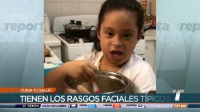 Cuida tu Salud: Síndrome de Down