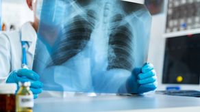 MINSA busca mitigar casos de tuberculosis en Panamá&nbsp;