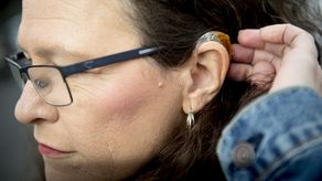 Los estadounidenses pueden pagar más de 5,000 dólares por una prótesis auditiva.