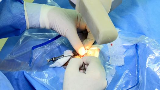 80 pacientes son beneficiados con la jornada de la CSS