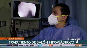 Beneficios del balón intragástrico para pacientes con sobrepeso