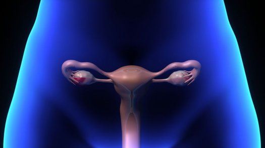 El sindrome de ovarios poliquisticos favorece la diabetes.