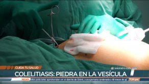 Cuida tu salud: Colelitiasis: piedra en la vesícula