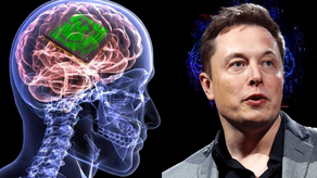 Elon Musk - Neuralink - implanta chip cerebral en primer paciente humano este lunes.&nbsp;