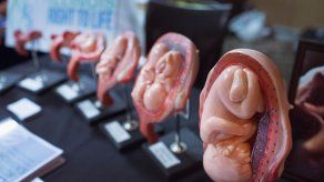 Supremo de México avala que mujeres pidan aborto si su salud está en riesgo