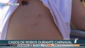 Presentan 57 denuncias por hurtos con destreza en Las Tablas Presentan 57 denuncias por hurtos con destreza en Las Tablas
