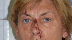 Policía croata busca ayudar a mujer que no recuerda quién es