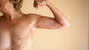 ¿En qué consiste la reconstrucción mamaria?