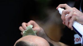 Inventan nueva técnica para injertar cabellos y combatir la calvicie