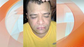 Privado de libertad se cose la boca y párpados para exigir revisión del expediente