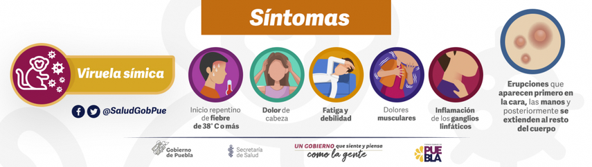 Viruela símica síntomas