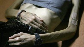 Casi un millón de australianos padece de trastornos de alimentación