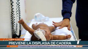 Cuida tu Salud: Tamizaje de cadera en bebés