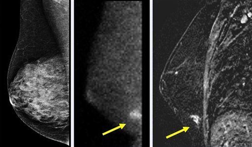 Desarrollan nueva cámara para exámenes de senos