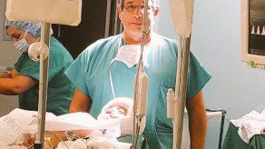 Médicos operan a uno de los siameses separados el sábado en Costa Rica