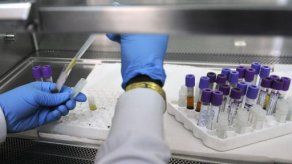 Epidemia del sida podría finalizar en 2030 (ONUSIDA)