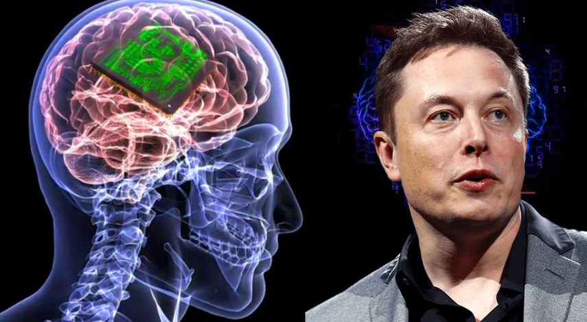 Elon Musk - Neuralink - implanta chip cerebral en primer paciente humano este lunes.&nbsp;