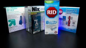 Política sobre piojos molesta  a padres en EEUU