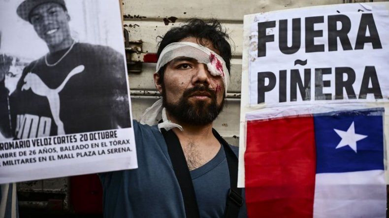 Pérdidas oculares en la represión de jóvenes manifestantes conmueve en Chile