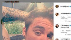 Justin Bieber estrena piercing y una funda de diamantes para los dientes