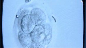 Guatemala analiza resarcir a infectados por experimento médico de EEUU