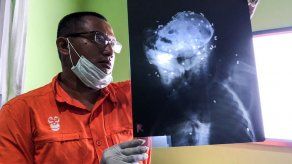 Asesinan a orangután en Indonesia: fue baleado y acuchillado