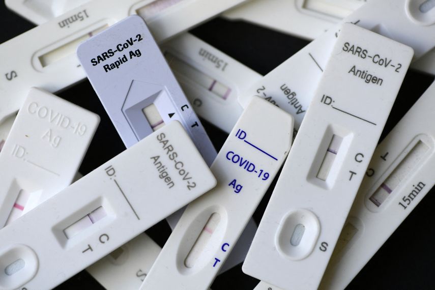Prueba rápida para detectar covid-19.