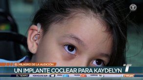 El milagro de la audición