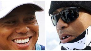 Woods relata el contratiempo que le costó un diente