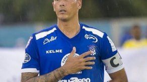 El Árabe Unido con cuatro bajas para enfrentar al Herediano en la Liga Concacaf