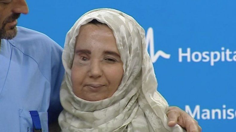 Médicos españoles reconstruyen el rostro a una mujer con grave deformación