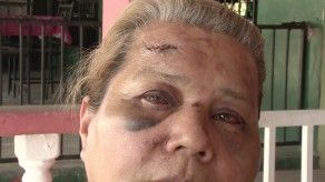 Delicuentes golpean a mujeres para robar en su residencia