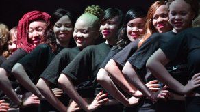 Un concurso de belleza de albinos para luchar contra los prejuicios en Kenia