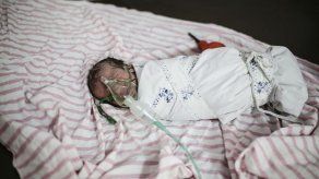 Nacimientos en Siria cayeron más del 50% desde inicio de la guerra