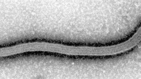 Descubren cómo el virus del ébola inhabilita el sistema de inmunidad