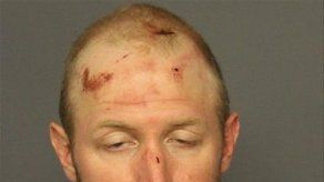 Acusan a hombre de robar tractor y morder perro