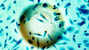 Investigadores crean nanopartícula que activa células contra el cáncer