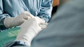 Inquietud por aumento de las cirugías estéticas genitales en Inglaterra