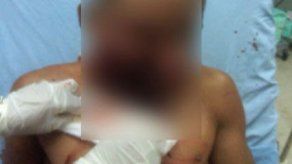 Impacto en rostro de Mauricio Méndez coincide con escopeta